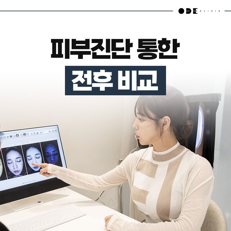 doctor consultation Ultherapy Prime Seoul
